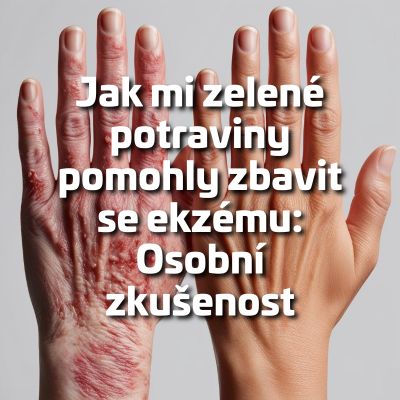Jak mi zelené potraviny pomohly zbavit se ekzému: Osobní zkušenost